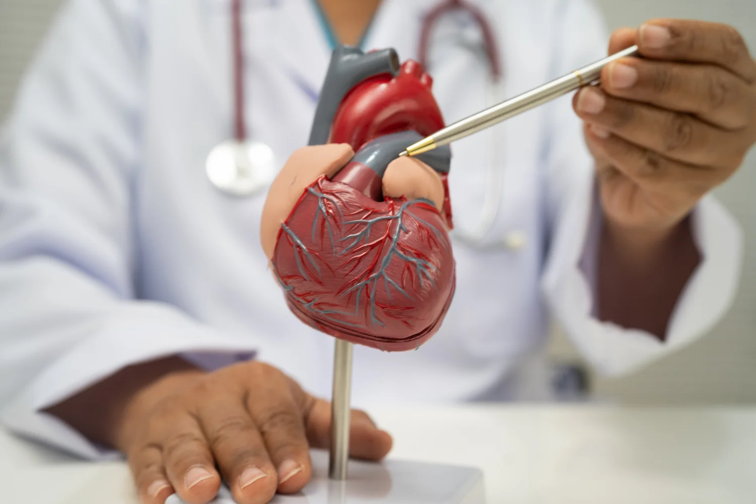 Médico apontando para um modelo anatômico do coração sobre doença arterial coronariana